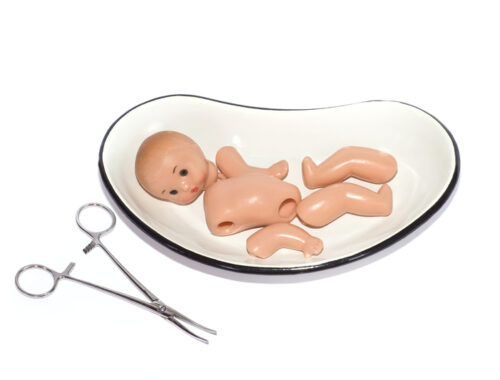 Brutális abortusz – fagysztóba téve öltek meg egy csecsemőt